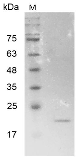 Recombinant MMP7 (Active), Human, AF