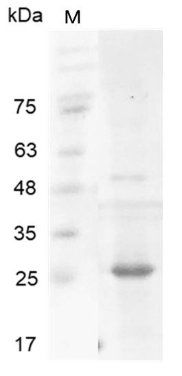 Recombinant MMP7 (Proenzyme), Human, AF