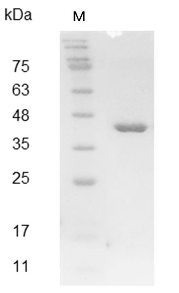 Recombinant OGG1 (8-oxoguanine DNA glycosylase), Human