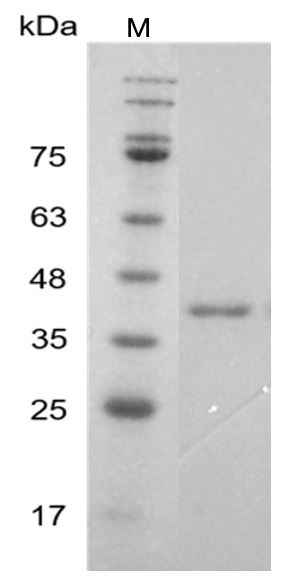 Recombinant RAGE (Receptor for advanced glycation endproducts), Human, AF