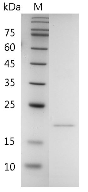 Recombinant RANKL (Receptor activator of nuclear factor kappa-Β ligand), Human, AF