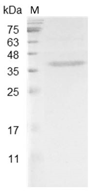 Recombinant HDGF (Hepatoma-derived growth factor), Mouse, AF