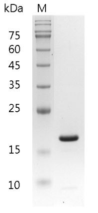 Recombinant IL-1 beta (Interleukin-1 beta), Mouse, AF