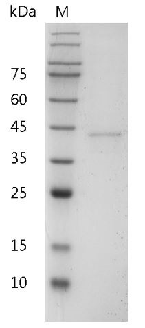 Recombinant IL-12 p40 (Interleukin-12 p40), Mouse, AF