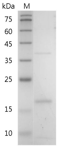 Recombinant IL-19 (Interleukin-19), Mouse, AF