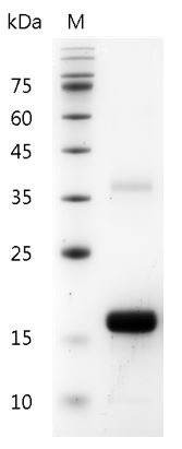 Recombinant IL-2 (Interleukin-2), Mouse, AF