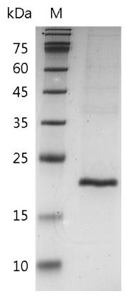 Recombinant TNF beta (Tumor necrosis factor beta), Mouse, AF