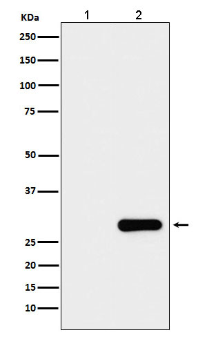 GFP tag Ab