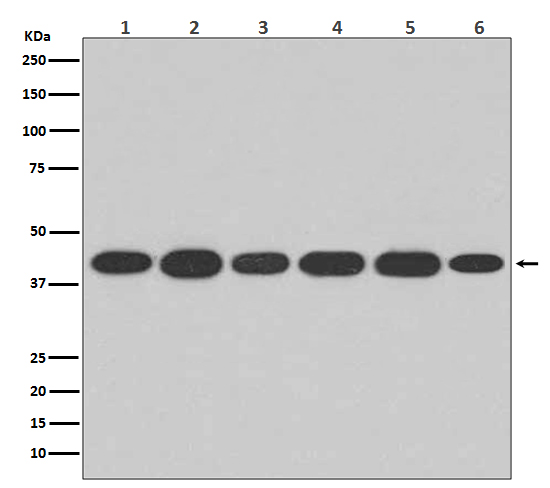 alpha Skeletal muscle actin Ab