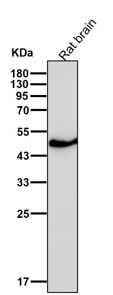 beta I Tubulin Ab