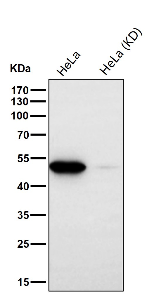 beta III Tubulin Ab