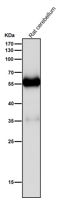 beta III Tubulin Ab