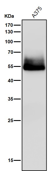 beta III Tubulin Ab