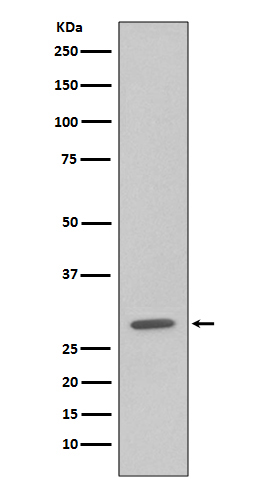 GFP tag Ab