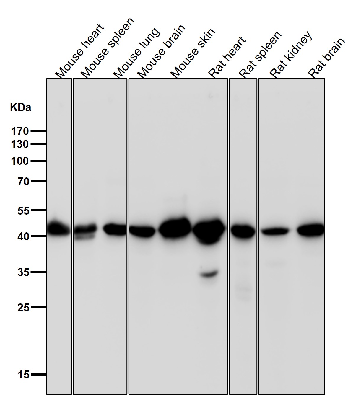 beta Actin Ab (HRP)