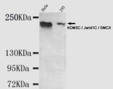 KDM5C Ab