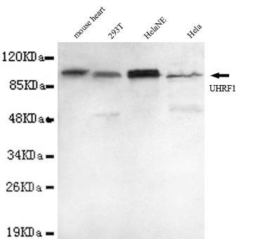 UHRF1 Ab