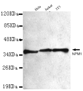 Nucleophosmin Ab