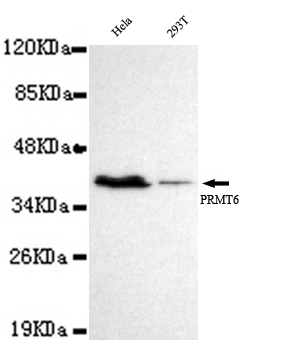 PRMT6 Ab