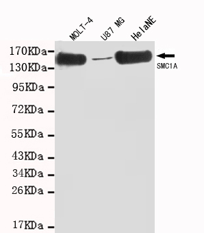 SMC1 alpha Ab