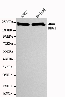 SMARCA4 Ab