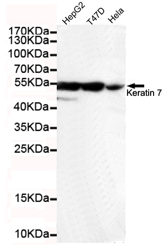 Cytokeratin 7 Ab