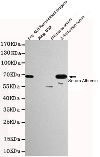 Albumin Ab