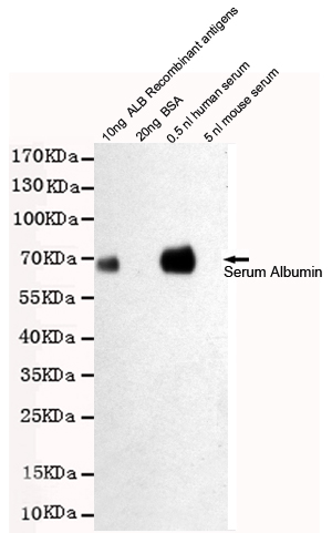 Albumin Ab