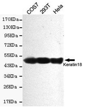 Cytokeratin 18 Ab