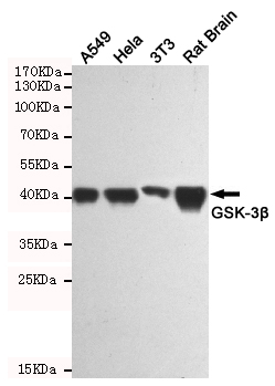 GSK 3 beta Ab