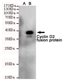 Cyclin D2 Ab