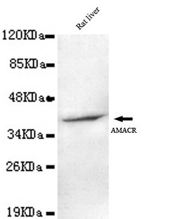 AMACR Ab