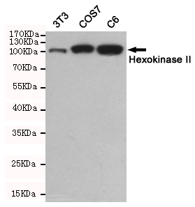 Hexokinase 2 Ab