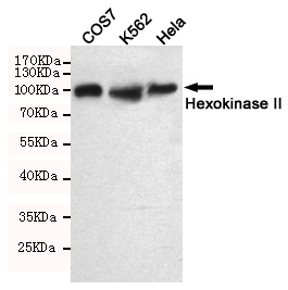 Hexokinase 2 Ab