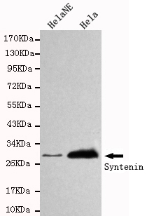 Syntenin 1 Ab