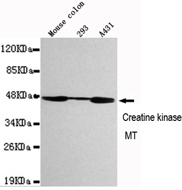 CKMT1 Ab