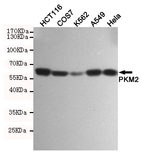 PKM Ab