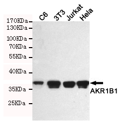 AKR1B1 Ab