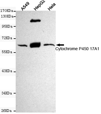 Cytochrome P450 17A1 Ab