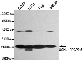 PGP9.5 Ab