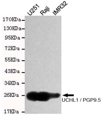 PGP9.5 Ab