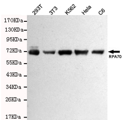 RPA p70 Ab