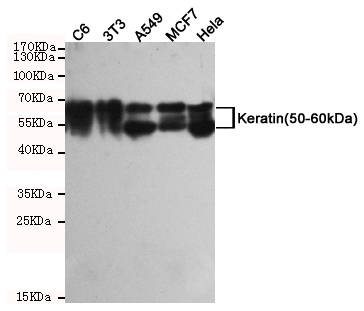 Cytokeratin 5 Ab