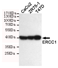 ERCC1 Ab