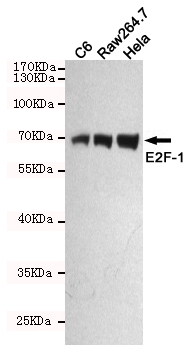 E2F1 Ab