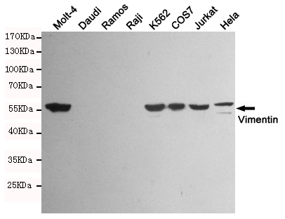 Vimentin Ab