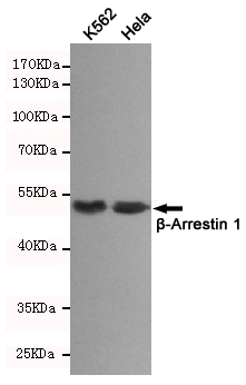 beta Arrestin 1 Ab