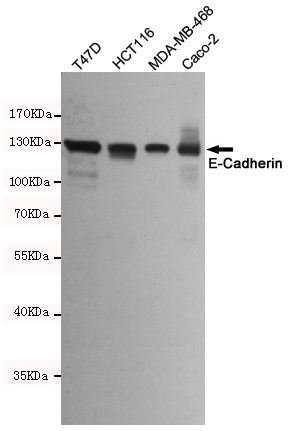 E Cadherin Ab