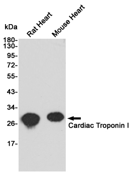 Troponin I Ab