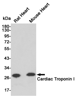 Troponin I Ab